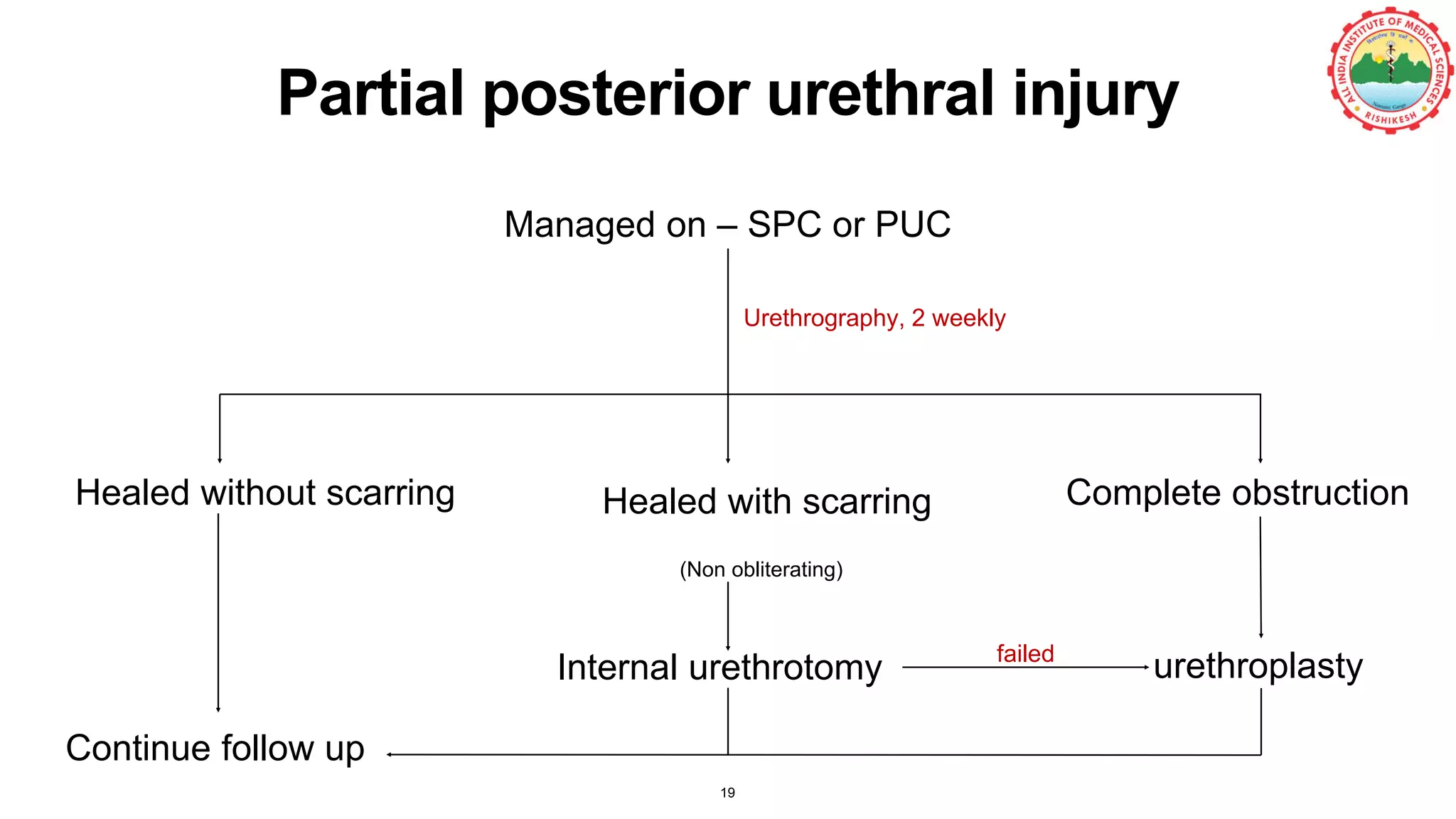Partial posterior urethral injury
Urethrography, 2 weekly
Managed on – SPC or PUC
Healed without scarring Healed with scarring
(Non obliterating)
Complete obstruction
Continue follow up
Internal urethrotomy urethroplastyfailed
19
 