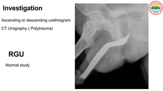 Approach to the patient with Urethral Trauma | PPTX