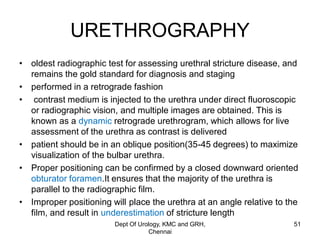 Urethra stricture etiopathogenesis & evaluation | PDF