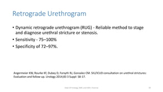 Retrograde Urethrogram
• Dynamic retrograde urethrogram (RUG) - Reliable method to stage
and diagnose urethral stricture or stenosis.
• Sensitivity - 75–100%
• Specificity of 72–97%.
Angermeier KW, Rourke KF, Dubey D, Forsyth RJ, Gonzalez CM. SIU/ICUD consultation on urethral strictures:
Evaluation and follow-up. Urology 2014;83 3 Suppl: S8-17.
Dept Of Urology, KMC and GRH, Chennai 29
 