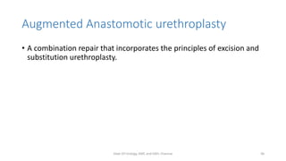 Augmented Anastomotic urethroplasty
• A combination repair that incorporates the principles of excision and
substitution urethroplasty.
Dept Of Urology, KMC and GRH, Chennai 46
 