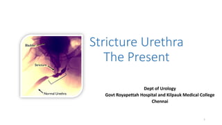 Stricture Urethra
The Present
Dept of Urology
Govt Royapettah Hospital and Kilpauk Medical College
Chennai
1
 