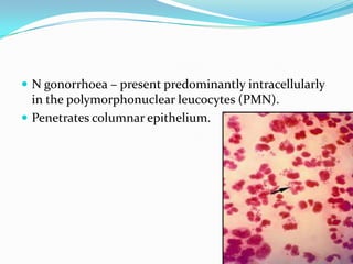  N gonorrhoea – present predominantly intracellularly

in the polymorphonuclear leucocytes (PMN).
 Penetrates columnar epithelium.

 