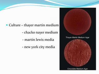  Culture – thayer martin medium

- chacko nayer medium
- martin lewis media
- new york city media

 