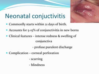 Neonatal conjuctivitis
 Commonlly starts within 21 days of birth.
 Accounts for 5-15% of conjunctivitis in new borns
 Clinical features – intense redness & swelling of

conjunctiva
- profuse purulent discharge
 Complication – corneal perforation

- scarring
- blindness

 