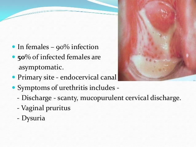 Urethritis