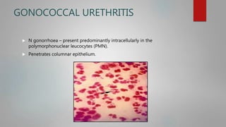 GONOCOCCAL URETHRITIS
 N gonorrhoea – present predominantly intracellularly in the
polymorphonuclear leucocytes (PMN).
 Penetrates columnar epithelium.
 