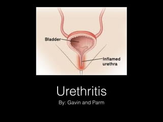 Urethritis
By: Gavin and Parm

 