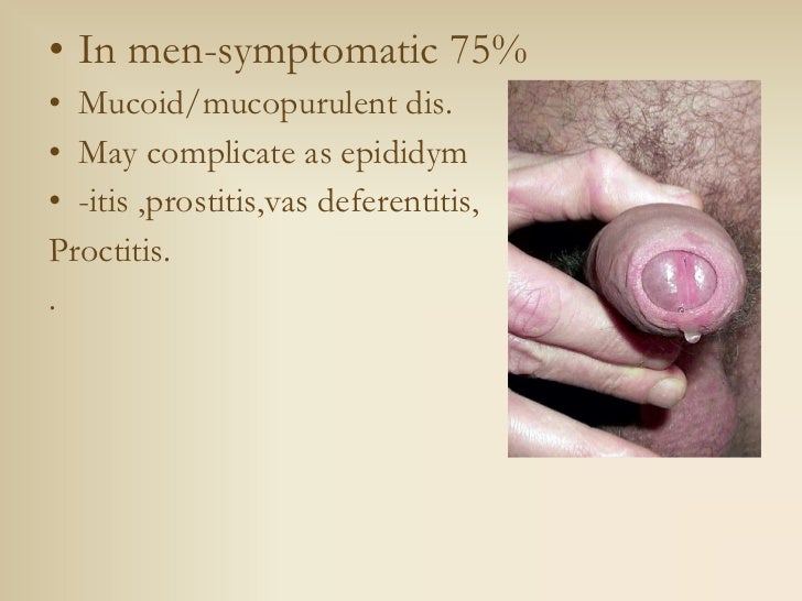 gonorrhea symptoms women discharge gonorrhea symptoms women discharge