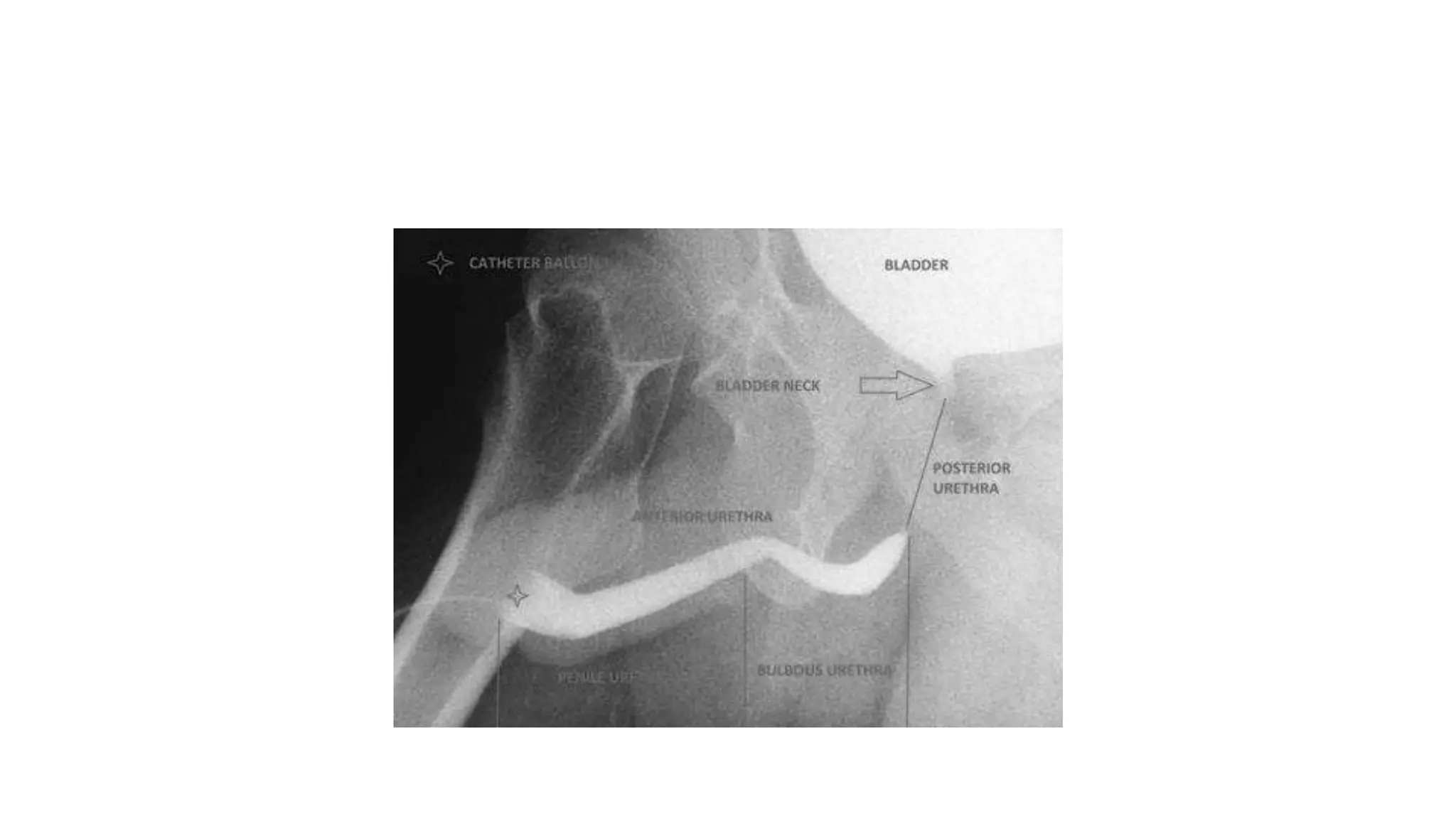 Steps Urethrogram urethrogram.pptx