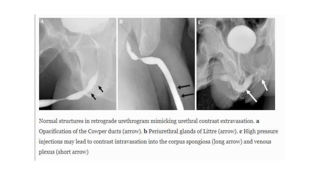 urethrogram.pptx