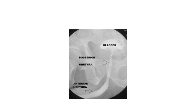 Steps Urethrogram urethrogram.pptx