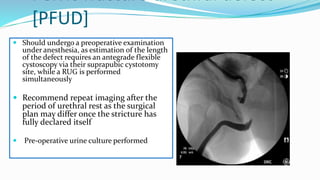 Pelvic fracture urethral defect
[PFUD]
 Should undergo a preoperative examination
under anesthesia, as estimation of the length
of the defect requires an antegrade flexible
cystoscopy via their suprapubic cystotomy
site, while a RUG is performed
simultaneously
 Recommend repeat imaging after the
period of urethral rest as the surgical
plan may differ once the stricture has
fully declared itself
 Pre-operative urine culture performed
 