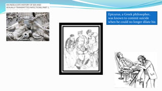 Epicurus, a Greek philosopher,
was known to commit suicide
when he could no longer dilate his
own stricture
 