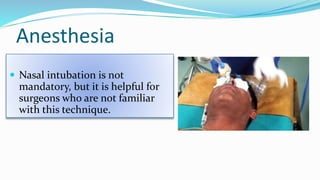 Anesthesia
 Nasal intubation is not
mandatory, but it is helpful for
surgeons who are not familiar
with this technique.
 