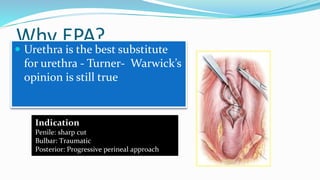 Why EPA?
 Urethra is the best substitute
for urethra - Turner- Warwick’s
opinion is still true
Indication
Penile: sharp cut
Bulbar: Traumatic
Posterior: Progressive perineal approach
 