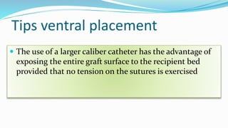 Tips ventral placement
 The use of a larger caliber catheter has the advantage of
exposing the entire graft surface to the recipient bed
provided that no tension on the sutures is exercised
 