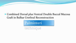  Combined Dorsal plus Ventral Double Buccal Mucosa
Graft in Bulbar Urethral Reconstruction
Palminteri
technique
 