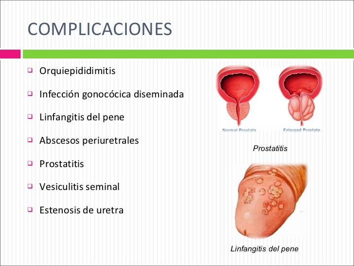 distributeur de savon moussant rechargeable pour les mains
