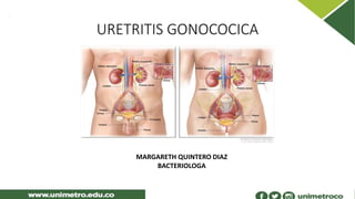 MARGARETH QUINTERO DIAZ
BACTERIOLOGA
URETRITIS GONOCOCICA
 