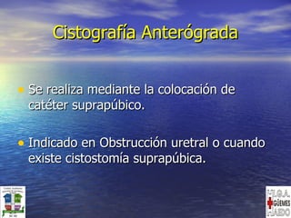 Cistografía Anterógrada Se realiza mediante la colocación de catéter suprapúbico. Indicado en Obstrucción uretral o cuando existe cistostomía suprapúbica.  