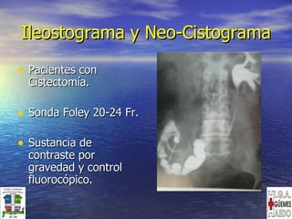 Ileostograma y Neo-Cistograma Pacientes con Cistectomía.  Sonda Foley 20-24 Fr. Sustancia de contraste por gravedad y control fluorocópico. 