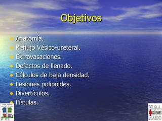 Objetivos Anatomía. Reflujo Vésico-ureteral. Extravasaciones. Defectos de llenado. Cálculos de baja densidad. Lesiones polipoides. Divertículos. Fístulas. 
