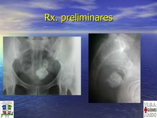 Rx. preliminares 