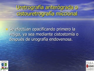 Uretrografía anterógrada o cistouretrografía miccional Se efectúan opacificando primero la vejiga, ya sea mediante cistostomía o después de urografía endovenosa. 