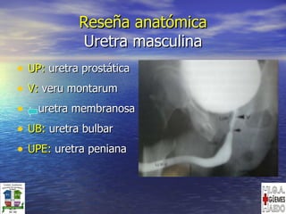 Reseña anatómica Uretra masculina UP:  uretra prostática V:  veru montarum uretra membranosa UB:  uretra bulbar UPE:  uretra peniana 