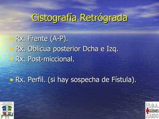 Cistografía Retrógrada Rx. Frente (A-P). Rx. Oblicua posterior Dcha e Izq. Rx. Post-miccional. Rx. Perfil. (si hay sospecha de Fístula).  