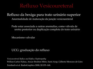 Refluxo da bexiga para trato urinário superior
Anormalidade de maturação da junção vesicoureteral
Pode estar associada a outras anomalias, como válvula de
uretra posterior ou duplicação completa do trato urinário
Mecanismo valvular
UCG: graduação do refluxo
Vesicoureteral Reflux and Reflux Nephropathy
Willian Carlos Nahas, Anuar Ibrahim Mitre, Sami Arap, Gilberto Menezes de Góes
Fernbach et al. RadioGraphics 2000; 20:155–168.
 