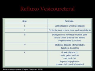 Refluxo vesicoureteral, Projeto Diretrizes, 2006.
 