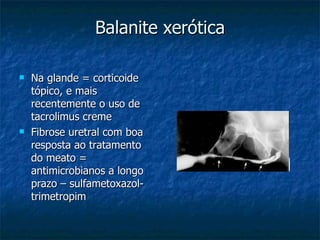 Balanite xerótica Na glande = corticoide tópico, e mais recentemente o uso de tacrolimus creme Fibrose uretral com boa resposta ao tratamento do meato = antimicrobianos a longo prazo – sulfametoxazol-trimetropim 