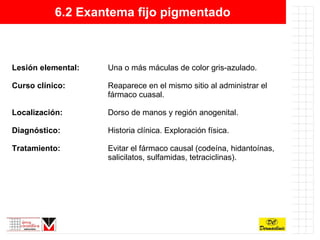 6.2 Exantema fijo pigmentado Lesión elemental: Una o más máculas de color gris-azulado. Curso clínico: Reaparece en el mismo sitio al administrar el  fármaco cuasal. Localización: Dorso de manos y región anogenital. Diagnóstico:  Historia clínica. Exploración física. Tratamiento: Evitar el fármaco causal (codeína, hidantoínas,  salicilatos, sulfamidas, tetraciclinas). 