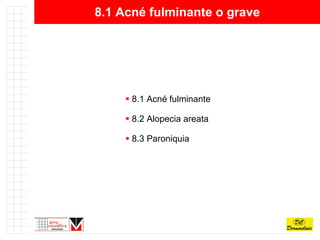 8.1 Acné fulminante o grave 8.1 Acné fulminante 8.2 Alopecia areata 8.3 Paroniquia 