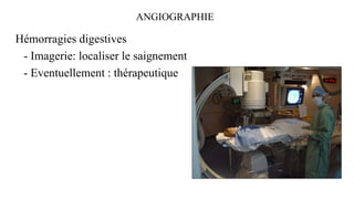 Hémorragies digestives
- Imagerie: localiser le saignement
- Eventuellement : thérapeutique
ANGIOGRAPHIE
 