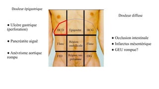 Douleur épigastrique
● Ulcère gastrique
(perforation)
● Pancréatite aiguë
● Anévrisme aortique
rompu
Douleur diffuse
● Occlusion intestinale
● Infarctus mésentérique
● GEU rompue?
 