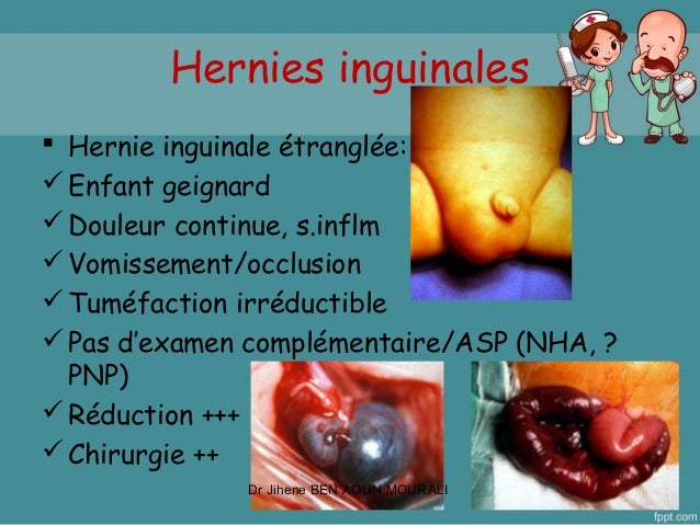 Urgences Chirurgicales Pediatriques Du Nourrisson Et Grand Enfant Urgences Chirurgicales Pediatriques Du Nourrisson Et Grand Enfant