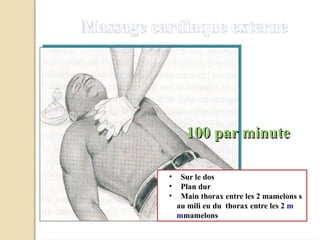 Massage cardiaque externe
100 par minute
• Sur le dos
• Plan dur
• Main thorax entre les 2 mamelons s
au mili eu du thorax entre les 2 m
mmamelons
 