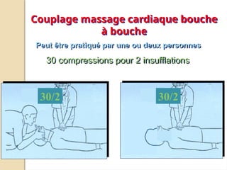 Couplage massage cardiaque bouche
à bouche
30 compressions pour 2 insufflations
Peut être pratiqué par une ou deux personnes
30/2 30/2
 