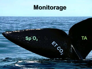 Monitorage
Sc
E
T
C
O
2
TA
Sp O2
 