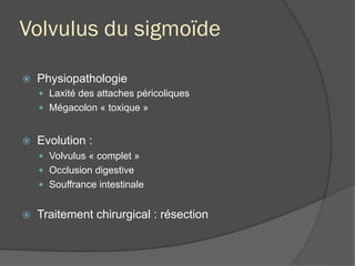 Volvulus du sigmoïde
ž  Physiopathologie
—  Laxité des attaches péricoliques
—  Mégacolon « toxique »
ž  Evolution :
—  Volvulus « complet »
—  Occlusion digestive
—  Souffrance intestinale
ž  Traitement chirurgical : résection
 