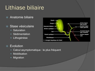 Lithiase biliaire
ž  Anatomie biliaire
ž  Stase vésiculaire
—  Saturation
—  Sédimentation
—  Lithogénèse
ž  Evolution
—  Calcul asymptomatique : le plus fréquent
—  Mobilisation
—  Migration
 