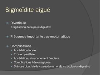 Sigmoïdite aiguë
ž  Diverticule
Fragilisation de la paroi digestive
ž  Fréquence importante : asymptomatique
ž  Complications
—  Abcédation locale
—  Erosion pariétale
—  Abcédation / cloisonnement / rupture
—  Complications hémorragiques
—  Sténose cicatricielle « pseudo-tumorale » / occlusion digestive
 