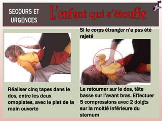 Réaliser cinq tapes dans le
dos, entre les deux
omoplates, avec le plat de la
main ouverte
Si le corps étranger n’a pas été
rejeté
Le retourner sur le dos, tête
basse sur l’avant bras. Effectuer
5 compressions avec 2 doigts
sur la moitié inférieure du
sternum
 