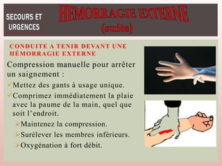 Compression manuelle pour arrêter
un saignement :
Mettez des gants à usage unique.
Comprimez immédiatement la plaie
avec la paume de la main, quel que
soit l’endroit.
Maintenez la compression.
Surélever les membres inférieurs.
Oxygénation à fort débit.
CONDUITE A TENIR DEVANT UNE
HÉMORRAGIE EXTERNE
 