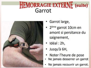 • Ne jamais desserrer un garrot
• Ne jamais recouvrir un garrot.
 