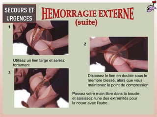 Utilisez un lien large et serrez
fortement
1
2
Disposez le lien en double sous le
membre blessé, alors que vous
maintenez le point de compression
3
Passez votre main libre dans la boucle
et saisissez l'une des extrémités pour
la nouer avec l'autre.
 
