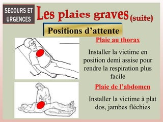 Positions d’attente
Plaie au thorax
Installer la victime en
position demi assise pour
rendre la respiration plus
facile
Plaie de l’abdomen
Installer la victime à plat
dos, jambes fléchies
 